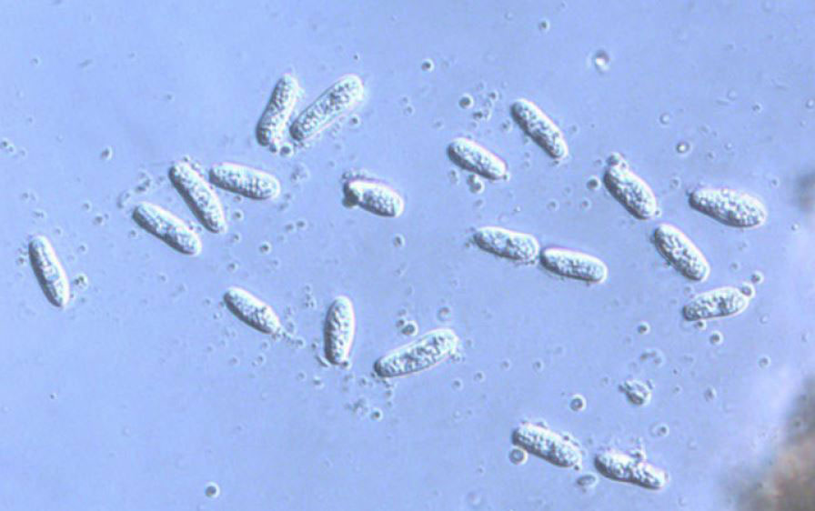 Image shows microscopic fungus that causes yew needle blight.