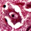 Rabies virus, image by Daniel P. Perl, CDC