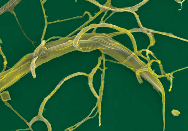 Gastrointestinal nematode being captured by DF fungus